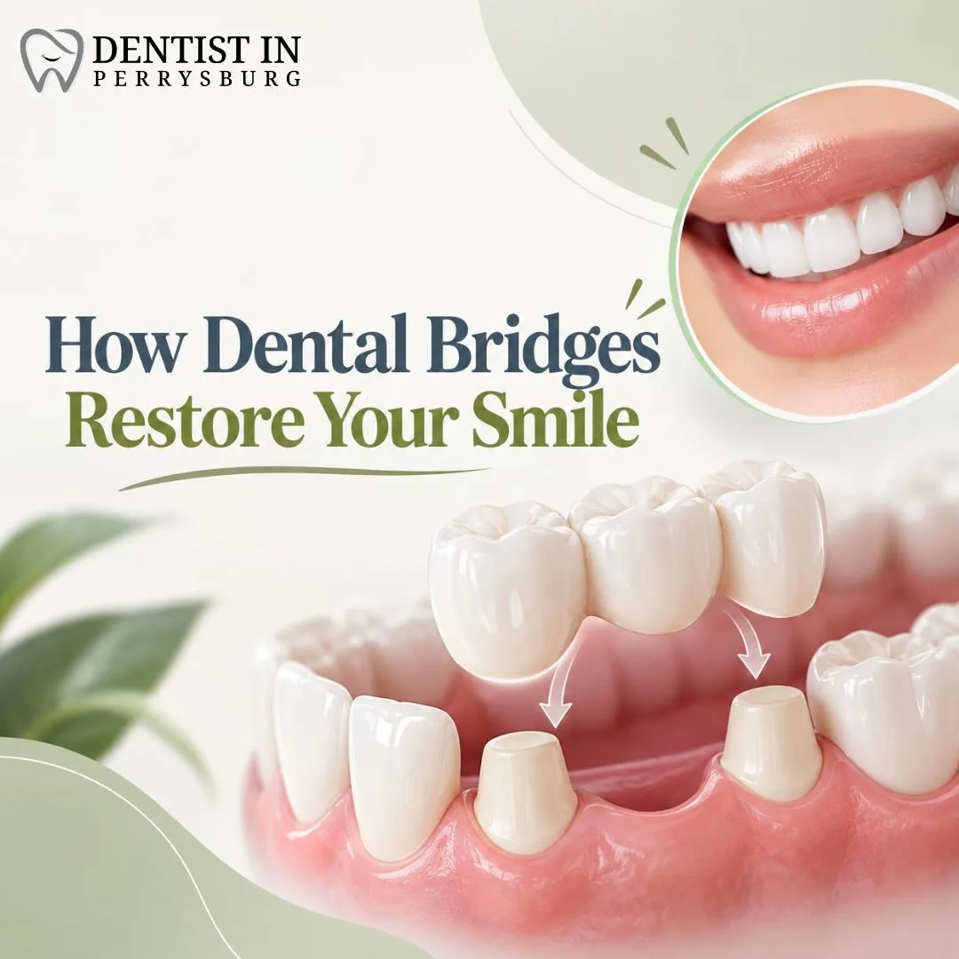 How Dental Bridges Restore Your Smile